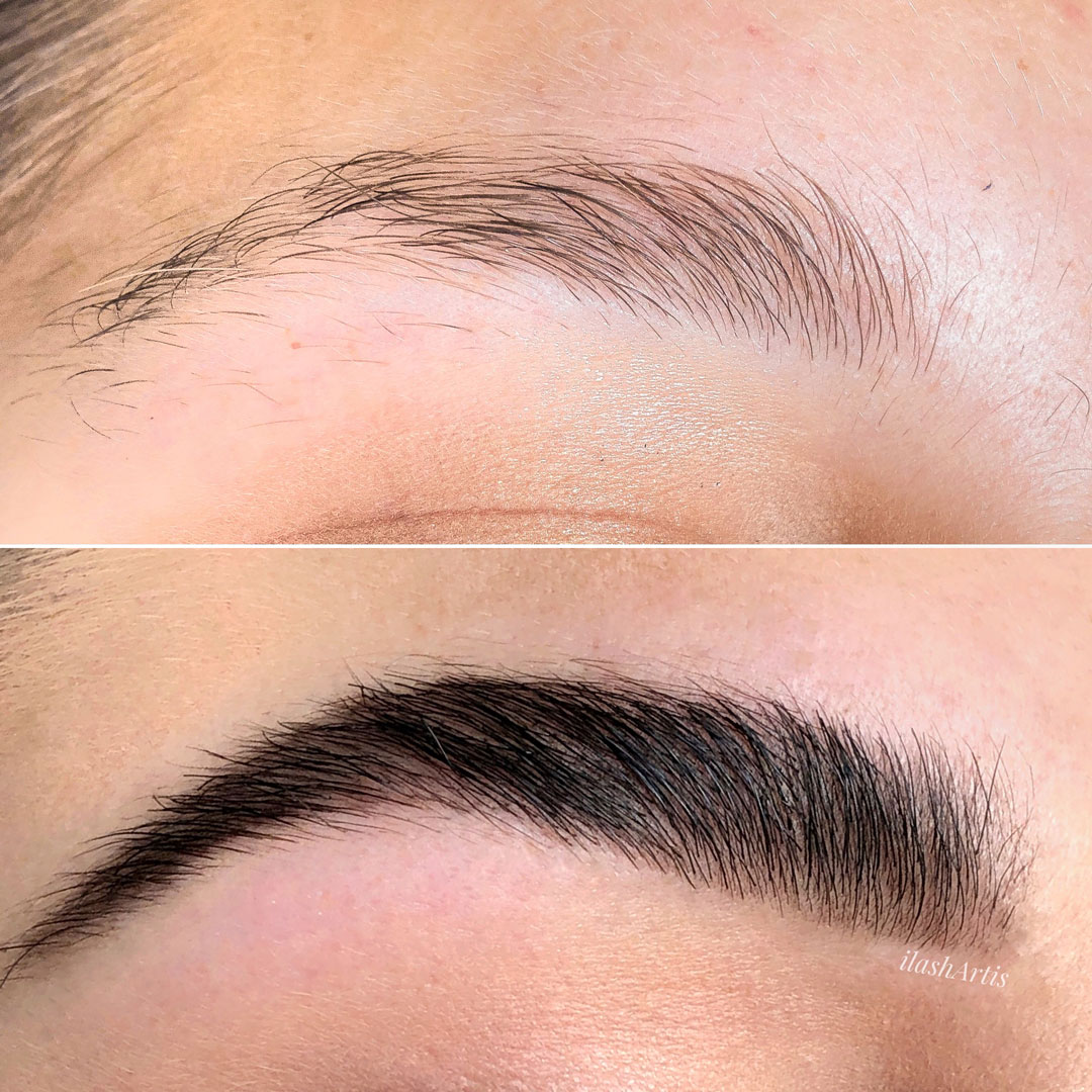 τι είναι το brow lamination
